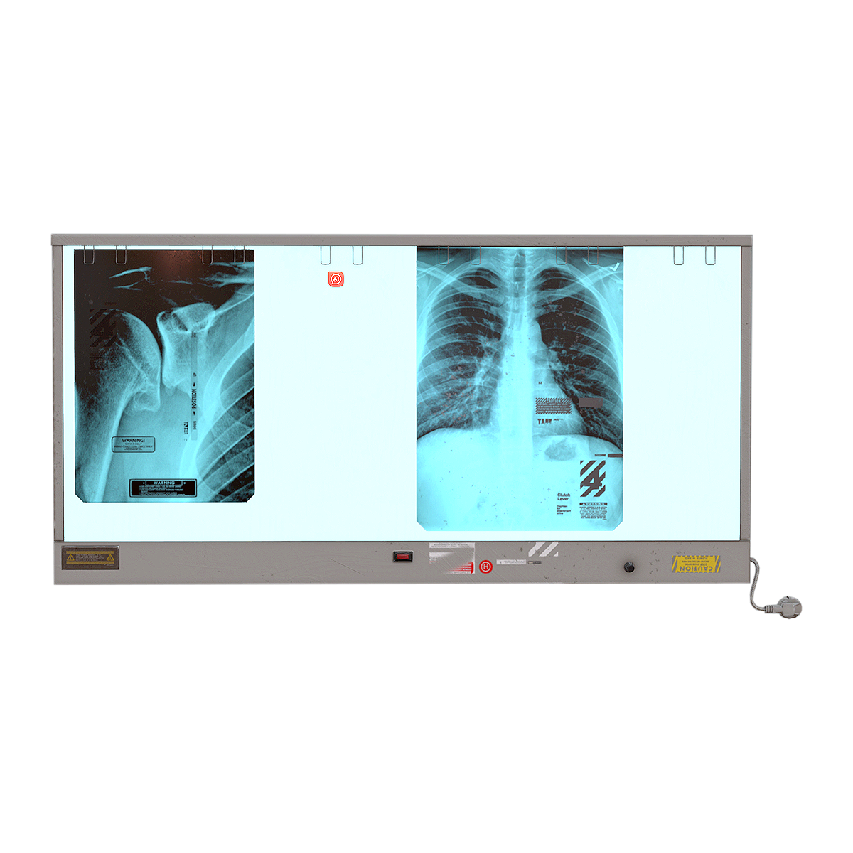 Medical X-ray fluoroscopy instrument