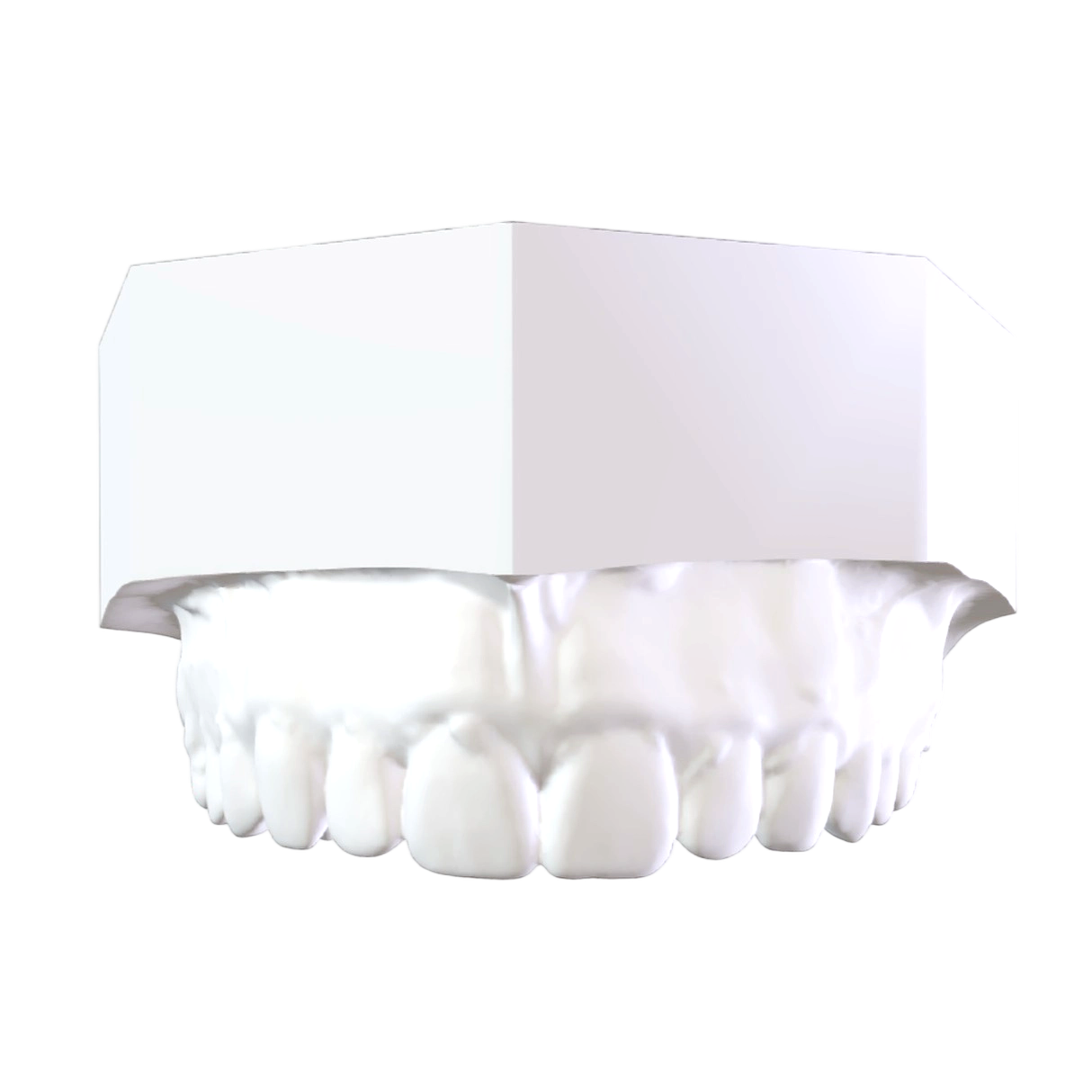 Maxillary model before orthodontic treatment